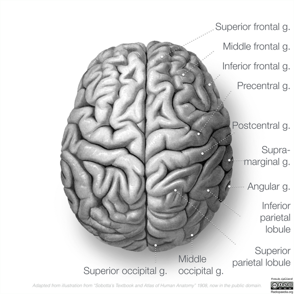 File:Neuroanatomy- superior cortex (diagrams) (Radiopaedia 59317-66667 B 3).png