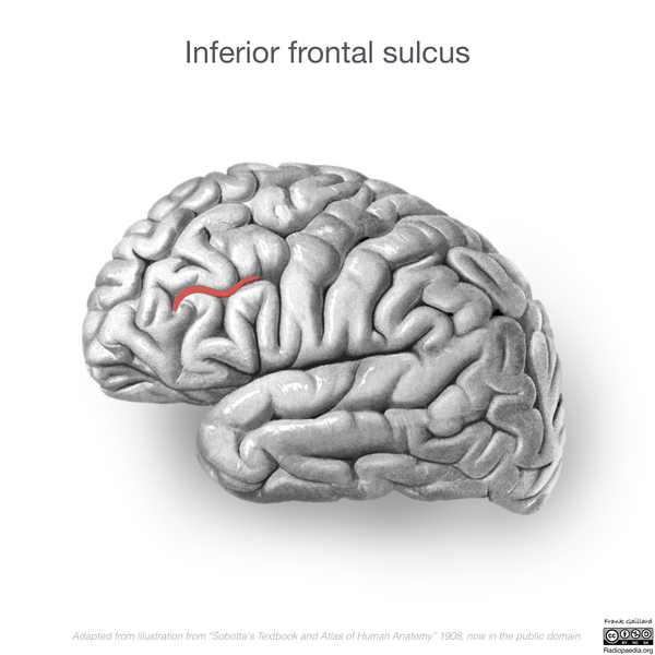File:Neuroanatomy- lateral cortex (diagrams) (Radiopaedia 46670-51202 B 2).png