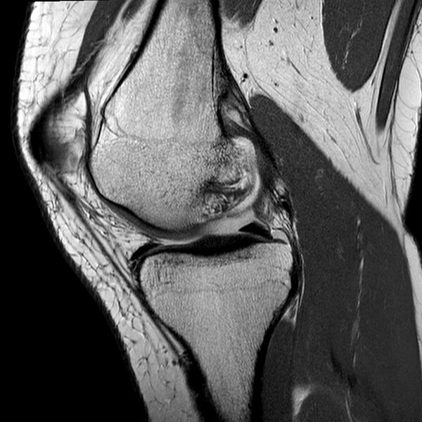 File:Anatomy Quiz (MRI knee) (Radiopaedia 43478-46865 A 9).jpeg