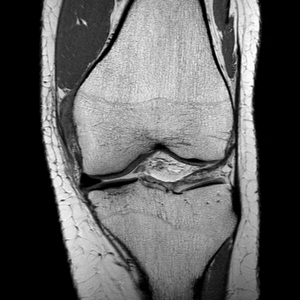 File:Anatomy Quiz (MRI knee) (Radiopaedia 43478-46874 A 12).jpeg