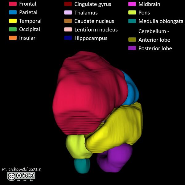 File:Brain lobes - annotated MRI (Radiopaedia 61691-69700 3D reconstruction 23).JPG
