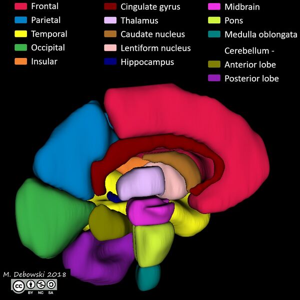 File:Brain lobes - annotated MRI (Radiopaedia 61691-69700 3D reconstruction 83).JPG