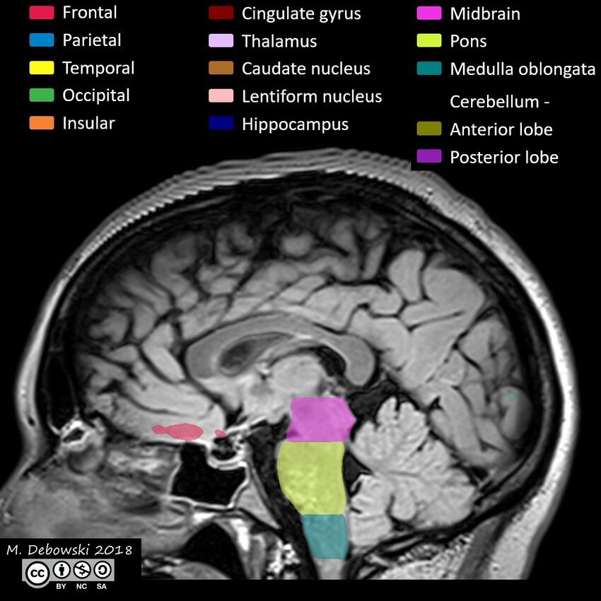 Brain lobes - annotated MRI (Radiopaedia 61691-69700 Sagittal 38).JPG