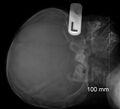 Normal skeletal survey - 5-month-old (Radiopaedia 53220-59186 Lateral 1).jpg