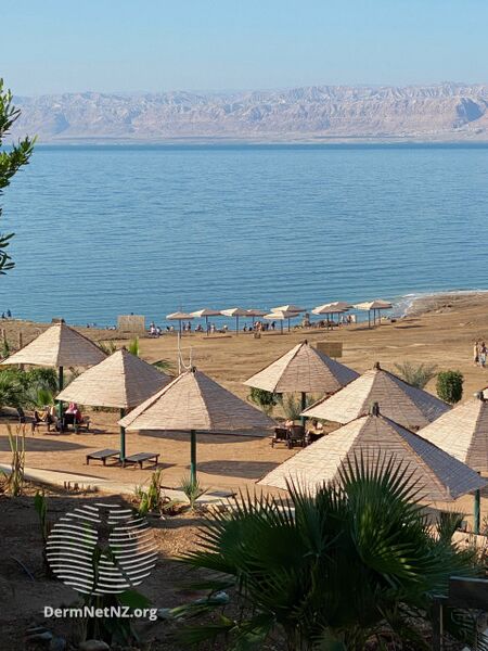 File:Dead Sea Spa (DermNet NZ dead-sea-spa-v3).jpg