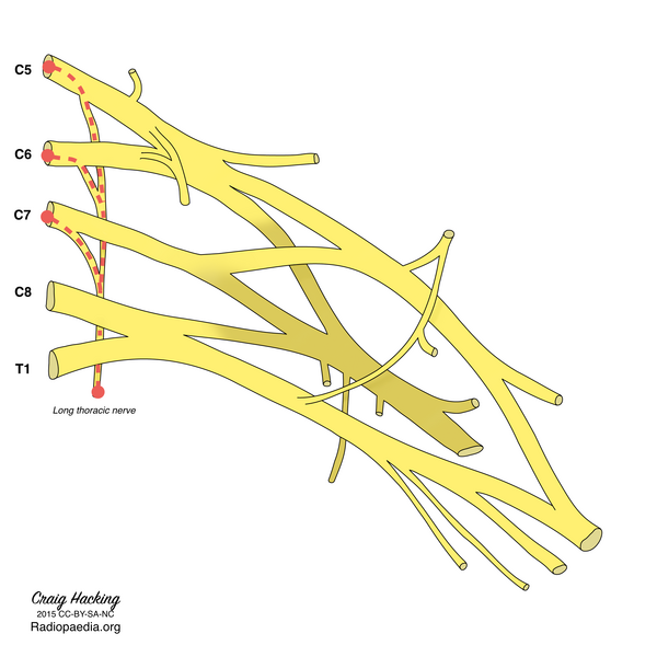 File:Brachial plexus (diagram) (Radiopaedia 37612-39492 Long thoracic nerve 1).png
