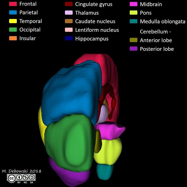File:Brain lobes - annotated MRI (Radiopaedia 61691-69700 3D reconstruction 67).JPG
