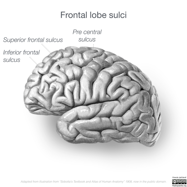 File:Neuroanatomy- lateral cortex (diagrams) (Radiopaedia 46670-51201 C 6).png