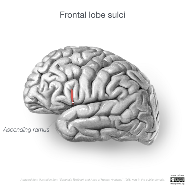 File:Neuroanatomy- lateral cortex (diagrams) (Radiopaedia 46670-51202 C 5).png