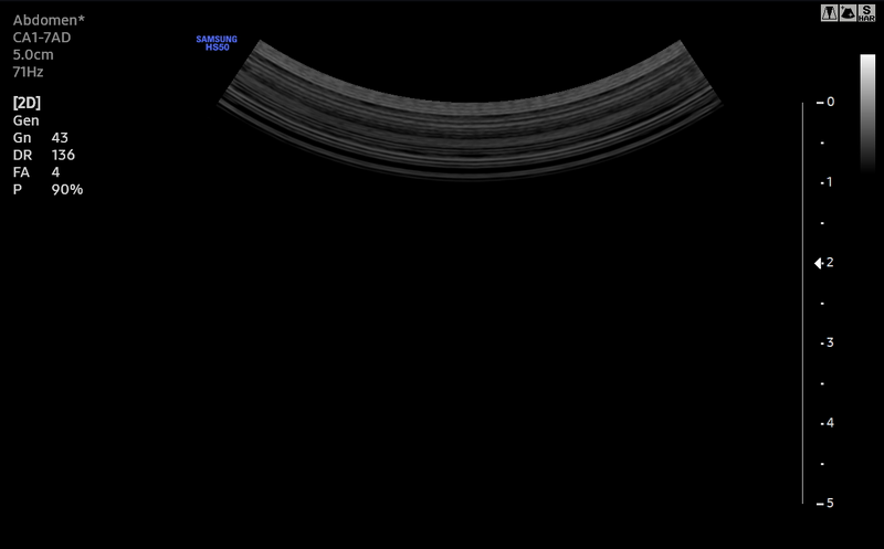 File:Normal in-air reverberation pattern - linear and curvilinear array transducers (Radiopaedia 85269-100836 B 1).png