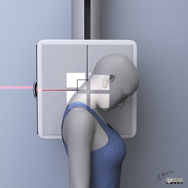 File:Cervical radiography - illustrations (Radiopaedia 80305-93666 None 5).jpg