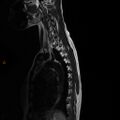 Normal spine MRI (Radiopaedia 77323-89408 E 13).jpg