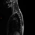 Normal spine MRI (Radiopaedia 77323-89408 E 15).jpg