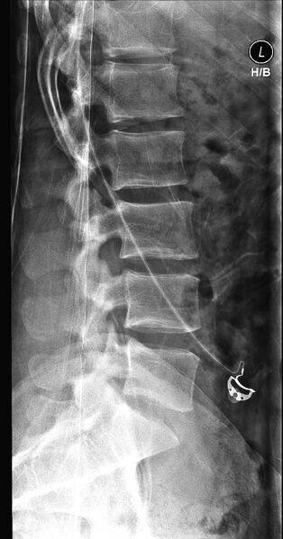 File:Normal trauma spine imaging (Radiopaedia 31753-32687 C 1).jpg