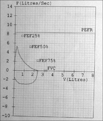 Tramadol-induced respiratory depression. Pulmonary function testing curves FVC 75% of predicted