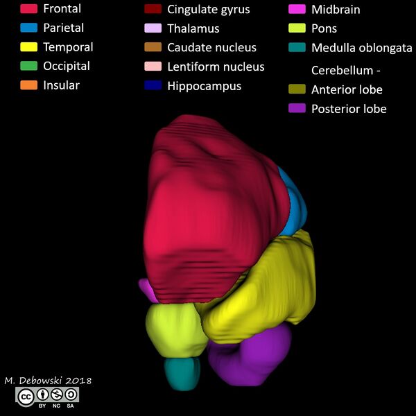 File:Brain lobes - annotated MRI (Radiopaedia 61691-69700 3D reconstruction 21).JPG