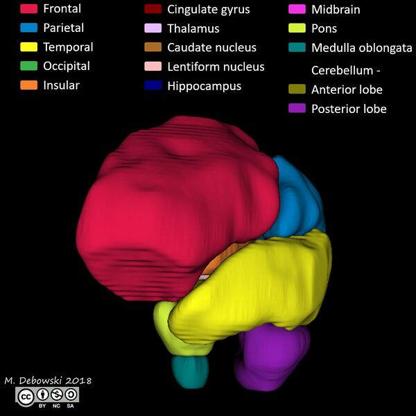 File:Brain lobes - annotated MRI (Radiopaedia 61691-69700 3D reconstruction 27).JPG