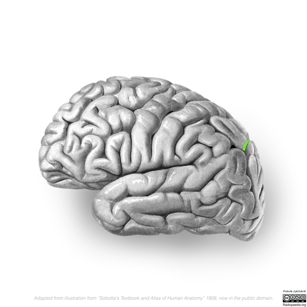 File:Neuroanatomy- lateral cortex (diagrams) (Radiopaedia 46670-51202 I 5).png