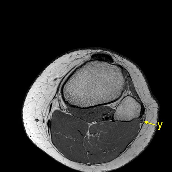 File:Anatomy Quiz (MRI knee) (Radiopaedia 43478-46866 A 26).jpeg