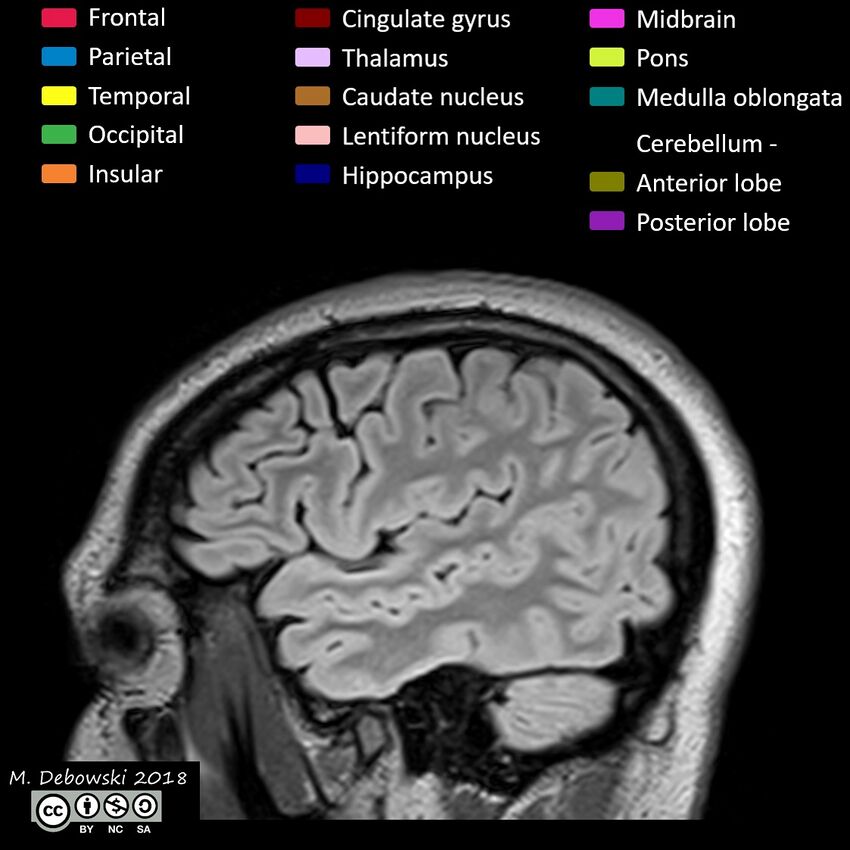 Brain lobes - annotated MRI (Radiopaedia 61691-69700 Sagittal 11).JPG