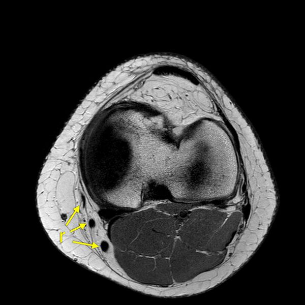 File:Anatomy Quiz (MRI knee) (Radiopaedia 43478-46866 A 19).jpeg