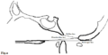Assessment of basilar invagination (Radiopaedia 27181-27349 Lateral 1).png