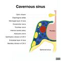 Cavernous sinus (illustration) (Radiopaedia 54907-61184 B 1).jpeg