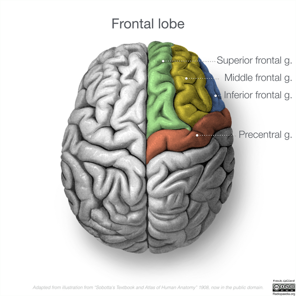 File:Neuroanatomy- superior cortex (diagrams) (Radiopaedia 59317-66670 Frontal lobe gyri 2).png