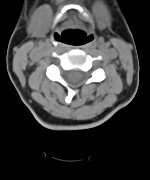 File:Normal cervical spine MRI (including Dixon) (Radiopaedia 42762-45926 Axial non-contrast 26).png