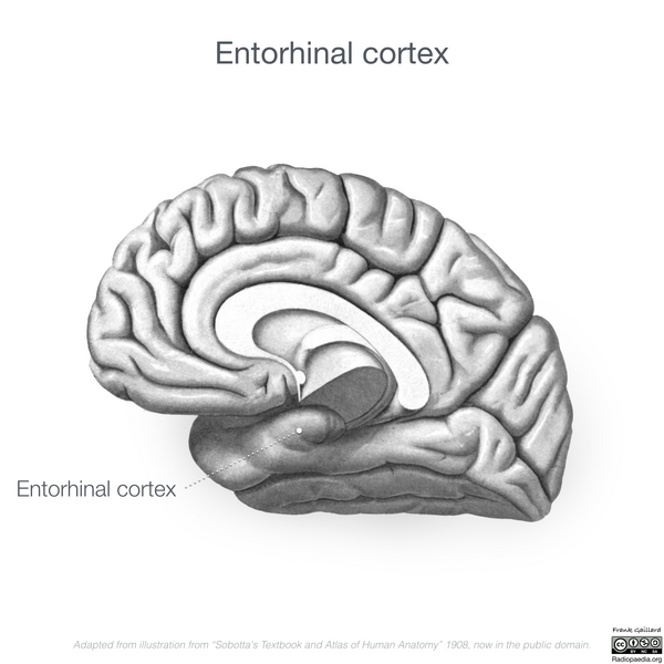 File:Neuroanatomy- medial cortex (diagrams) (Radiopaedia 47208-52697 Entorhinal cortex 5).png