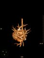 Aberrant left pulmonary artery (pulmonary sling) (Radiopaedia 42323-45435 3D reconstruction C+ CTPA 22).jpg