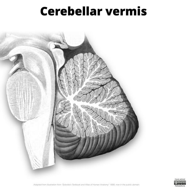 File:Cerebellar vermis (illustration) (Radiopaedia 90395-107720 F 1).jpg