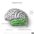 Neuroanatomy- lateral cortex (diagrams) (Radiopaedia 46670-51156 Temporal lobe 5).png