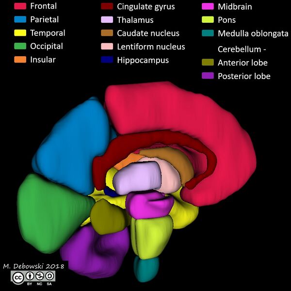 File:Brain lobes - annotated MRI (Radiopaedia 61691-69700 3D reconstruction 81).JPG