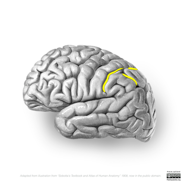 File:Neuroanatomy- lateral cortex (diagrams) (Radiopaedia 46670-51201 E 5).png