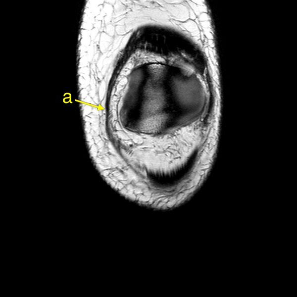 File:Anatomy Quiz (MRI knee) (Radiopaedia 43478-46874 A 2).jpeg