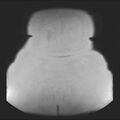 Normal liver MRI with Gadolinium (Radiopaedia 58913-66163 Coronal T2 43).jpg