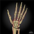 Arterial supply to the hand (illustrations) (Radiopaedia 55264-61677 Palmar 1).jpg