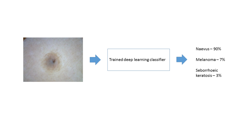 File:Inference produced by deep learning algorithms on a new image of a skin lesion. (DermNet NZ Fig3).png