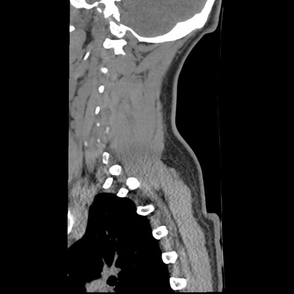 File:Normal trauma spine imaging (Radiopaedia 31753-32686 A 5).jpg