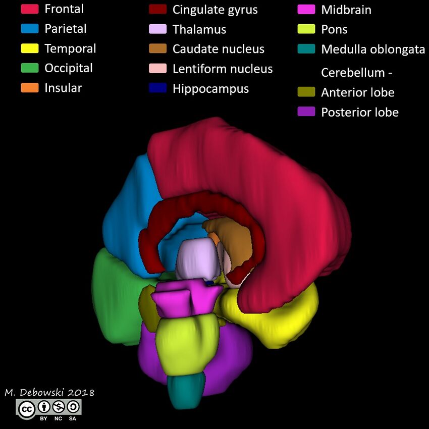 Brain lobes - annotated MRI (Radiopaedia 61691-69700 3D reconstruction 9).JPG