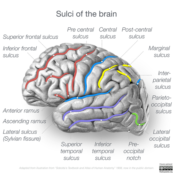File:Neuroanatomy- lateral cortex (diagrams) (Radiopaedia 46670-51201 Brain 3).png