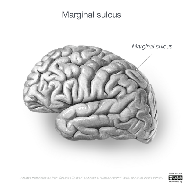 File:Neuroanatomy- lateral cortex (diagrams) (Radiopaedia 46670-51202 Marginal sulcus 3).png