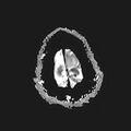 Neurotoxoplasmosis - concentric target sign (Radiopaedia 70644-80784 Axial ADC 23).jpg