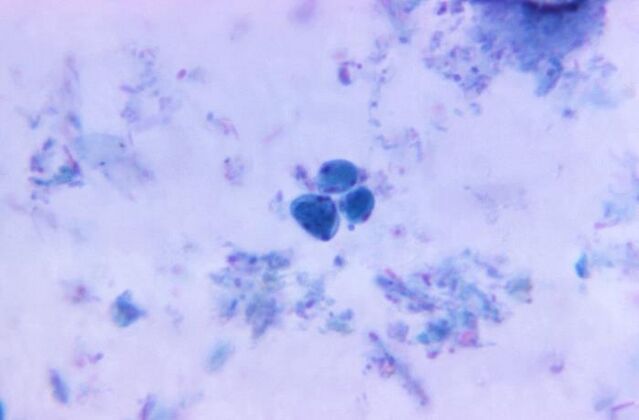 Blastocystis hominis protozoan cysts, each containing multiple nuclei located in the peripheral cytoplasm