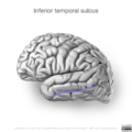 Neuroanatomy- lateral cortex (diagrams) (Radiopaedia 46670-51202 L 2).png