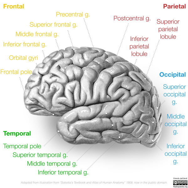 File:Neuroanatomy- lateral cortex (diagrams) (Radiopaedia 46670-51313 Gyri 2).png