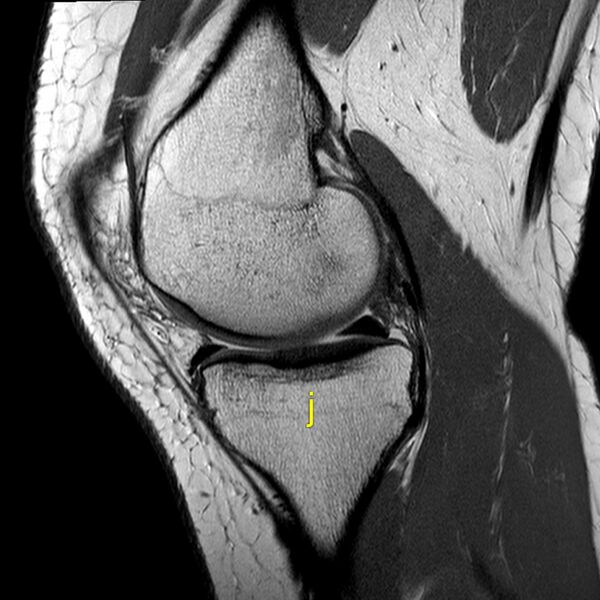 File:Anatomy Quiz (MRI knee) (Radiopaedia 43478-46865 A 8).jpeg