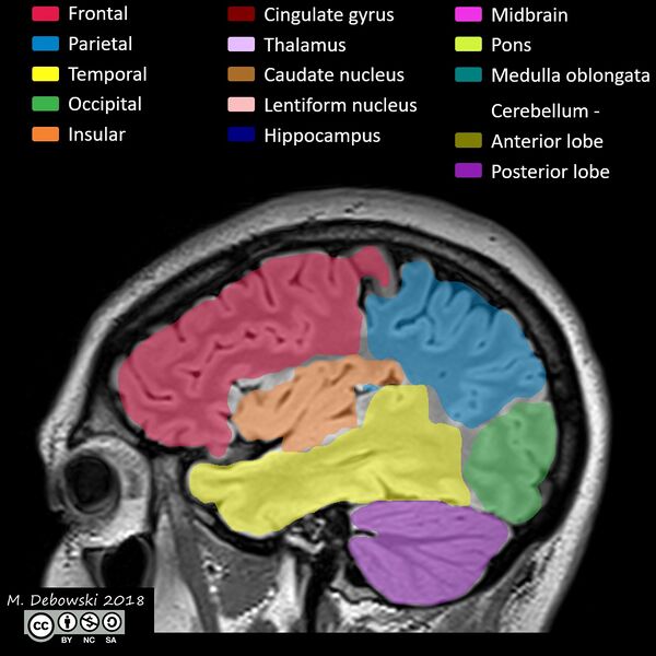 File:Brain lobes - annotated MRI (Radiopaedia 61691-69700 Sagittal 61).JPG