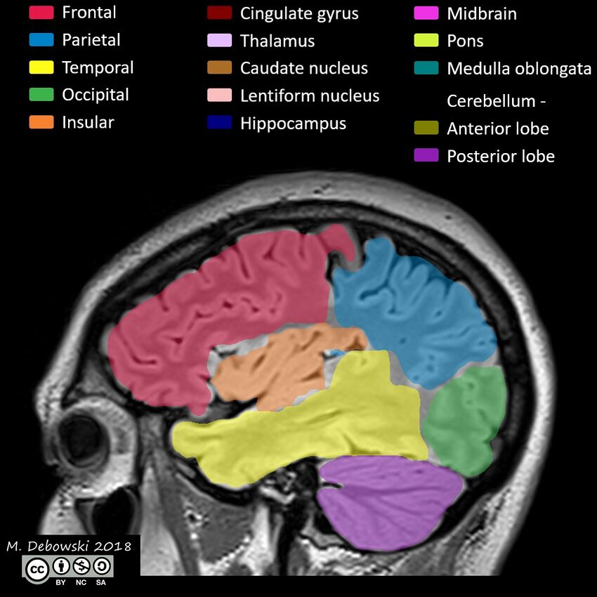 Brain lobes - annotated MRI (Radiopaedia 61691-69700 Sagittal 61).JPG